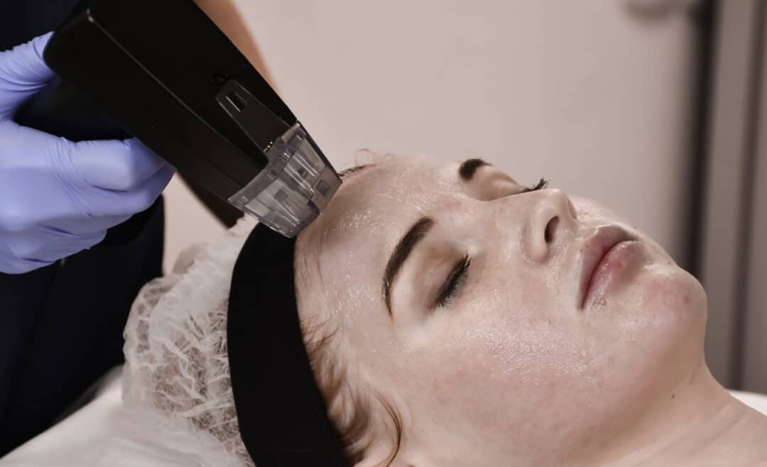 Discover the Benefits of Morpheus8: A Non-Invasive Skin Resurfacing Treatment